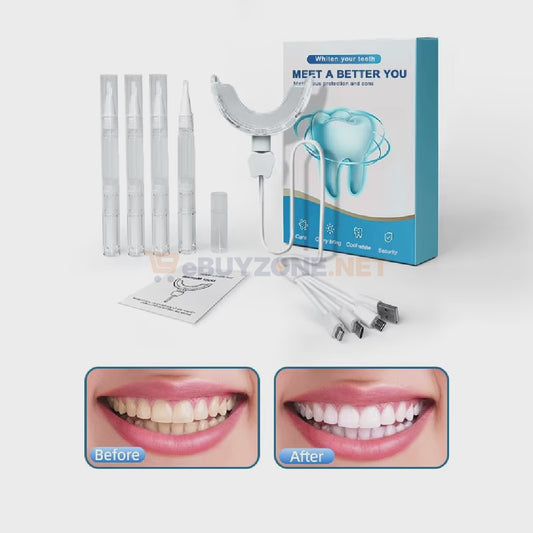 Kit blanchiment dentaire portable – sourire éclatant ✨