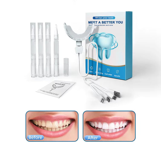 Kit blanchiment dentaire portable – sourire éclatant ✨
